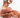 Rhabdomyolysis: A Breakdown of Sorts
